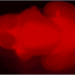 In my lab, we're performing experiments on mice where we inject a fluorescent tracer which travels in the blood. Here, we took a picture of a mouse brain where you can see that the tracer is very visible. It means that the barriers in our brains filtering the blood are not working properly. These mice were exposed to antibiotics when they were in utero.